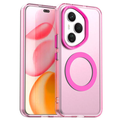 MagSafe pouzdro pro Honor 400 Pro, Techsuit, CandyCase, Růžová